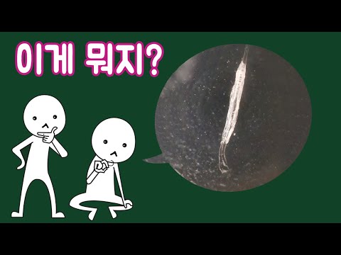 머리카락 뽑았을 때 끝에 투명한 건 뭘까?