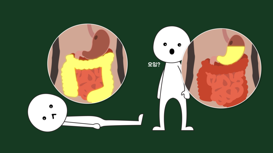 Gastroesophageal Reflux Disease 1