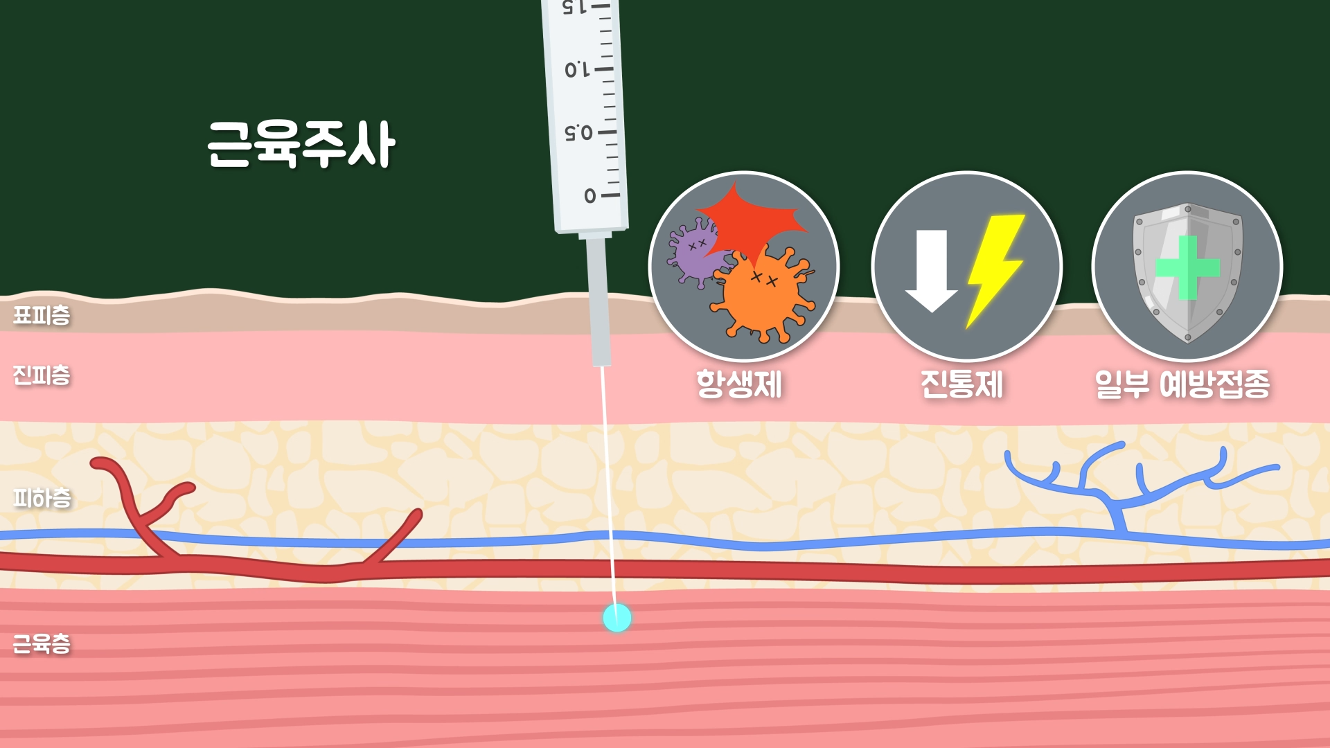 엉덩이 주사와 팔뚝 주사는 뭐가 다른 걸까?