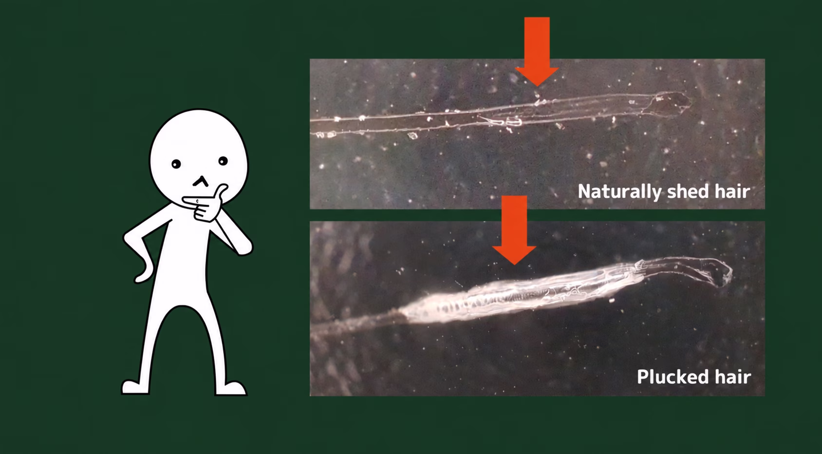 Microscopic comparison of naturally shed and plucked hairs