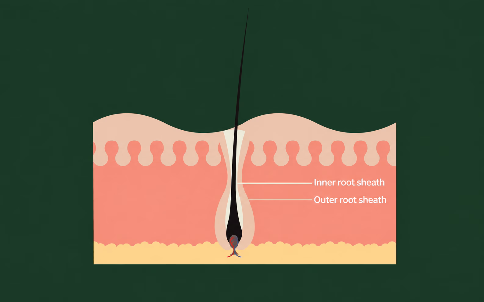 Inner and outer root sheaths surrounding a hair