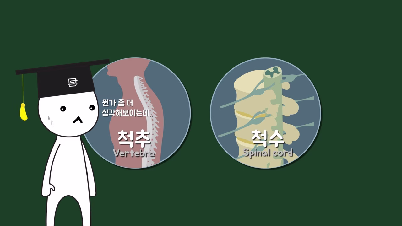 척추와 척수 손상의 위험에 관한 설명