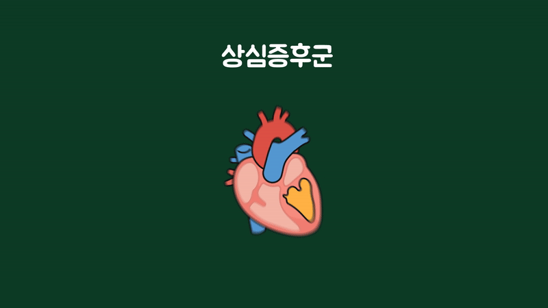 상심증후군에서 나타나는 심장 모양 변화
