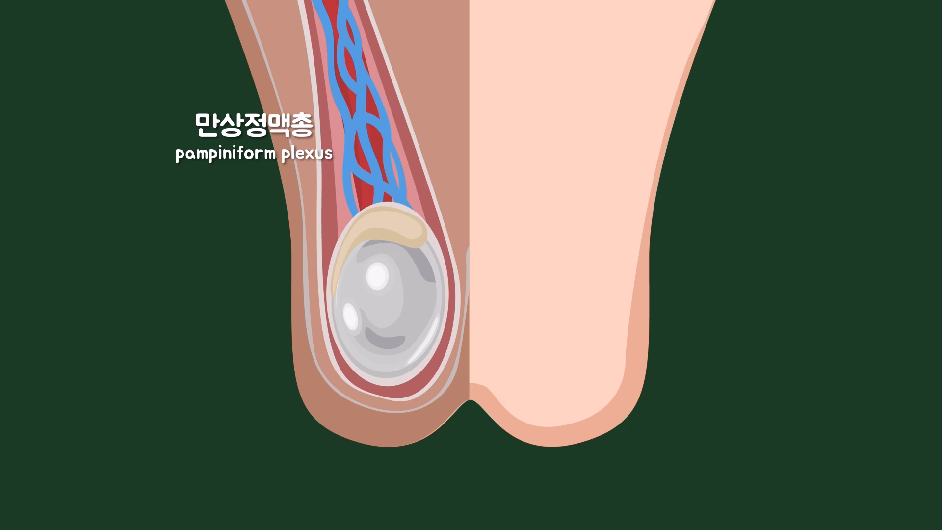 고환동맥 주변을 감싼 만상정맥총